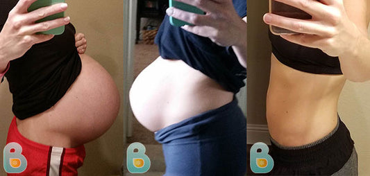 473-Chasidy-M-Bellefit-Results-Before-and-After-Bellefit-SLIDE
