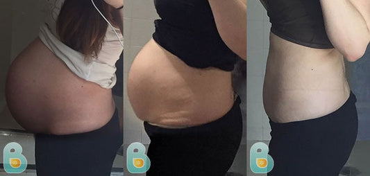 477-Maricela-T-Bellefit-Results-Before-and-After-Bellefit-SLIDE