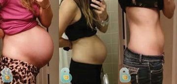 48-Elise-S-Bellefit-Results-Before-and-After-Bellefit-SLIDE