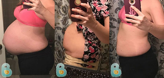 482-Hannah-B-Bellefit-Results-Before-and-After-Bellefit-SLIDE