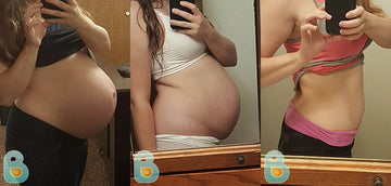 483-Tijana-J-Bellefit-Results-Before-and-After-Bellefit-SLIDE