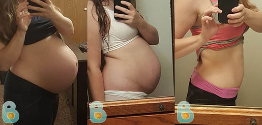 483-Tijana-J-Bellefit-Results-Before-and-After-Bellefit-SLIDE