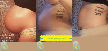485-Maren-S-Bellefit-Results-Before-and-After-Bellefit-SLIDE