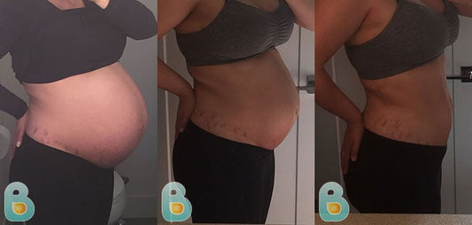 488-Michele-K-Bellefit-Results-Before-and-After-Bellefit-SLIDE