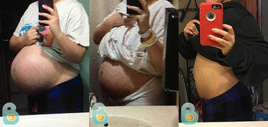489-Brianna-T-Bellefit-Results-Before-and-After-Bellefit-SLIDE
