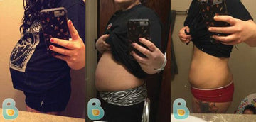 49-Elizabeth-R-Bellefit-Results-Before-and-After-Bellefit-SLIDE