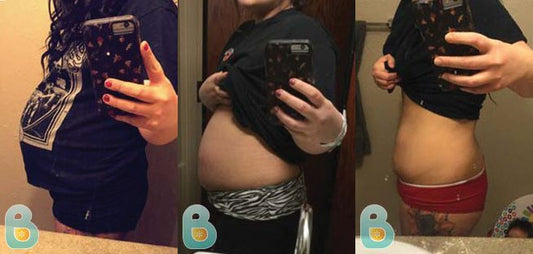 49-Elizabeth-R-Bellefit-Results-Before-and-After-Bellefit-SLIDE