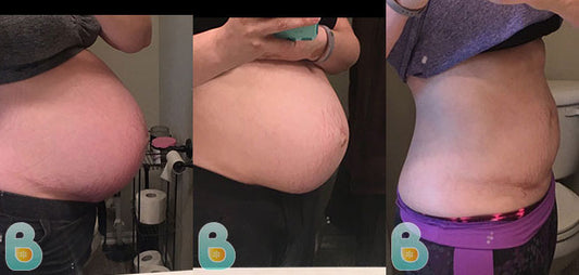 490-Adrienne-S-Bellefit-Results-Before-and-After-Bellefit-SLIDE