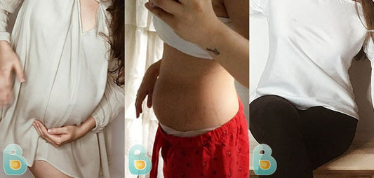 491-Maya-V-Bellefit-Results-Before-and-After-Bellefit-SLIDE
