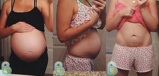 492-Emily-D-Bellefit-Results-Before-and-After-Bellefit-SLIDE
