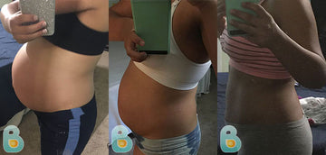 496-Yeraldin-O-Bellefit-Results-Before-and-After-Bellefit-SLIDE