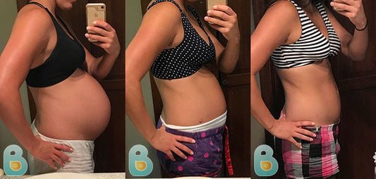 499-Janelle-H-Bellefit-Results-Before-and-After-Bellefit-SLIDE