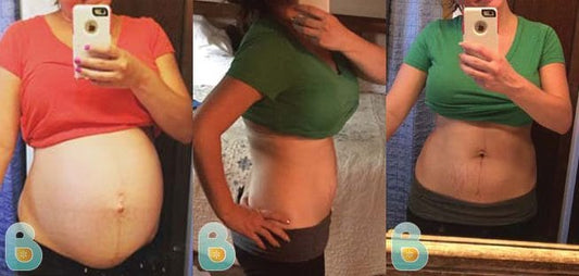 5-Amanda-C-Bellefit-Results-Before-and-After-Bellefit-SLIDE