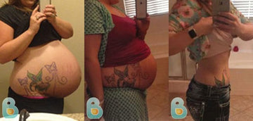 50-Elizabeth-W-Bellefit-Results-Before-and-After-Bellefit-SLIDE