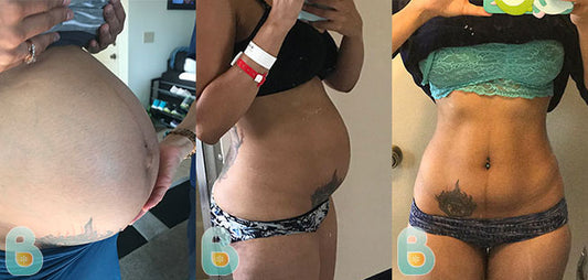 501-Christma-M-Bellefit-Results-Before-and-After-Bellefit-SLIDE