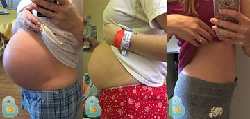 502-Vickie-R-Bellefit-Results-Before-and-After-Bellefit-SLIDE
