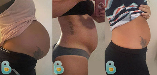 504-Jennifer-N-Bellefit-Results-Before-and-After-Bellefit-SLIDE