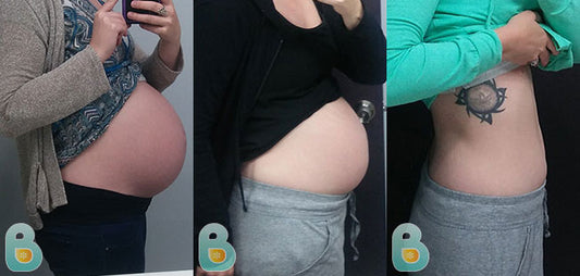 505-Katie-W-Bellefit-Results-Before-and-After-Bellefit-SLIDE