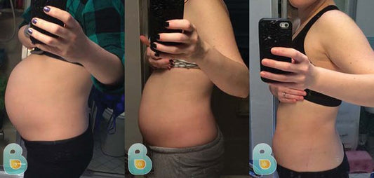 52-Emily-H-Bellefit-Results-Before-and-After-Bellefit-SLIDE