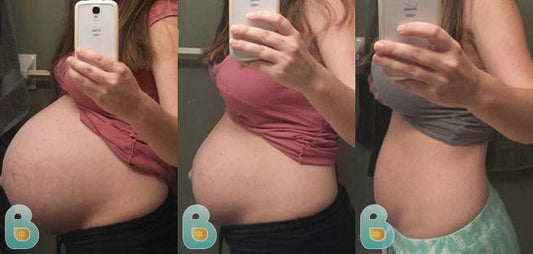 53-Erica-T-Bellefit-Results-Before-and-After-Bellefit-SLIDE