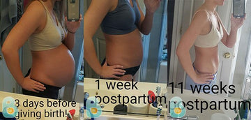 54-Erica-D-Bellefit-Results-Before-and-After-Bellefit-SLIDE