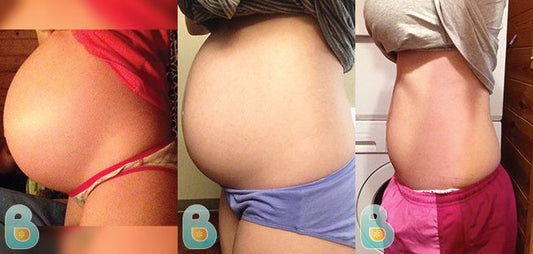 55-Erin-L-Bellefit-Results-Before-and-After-Bellefit-SLIDE