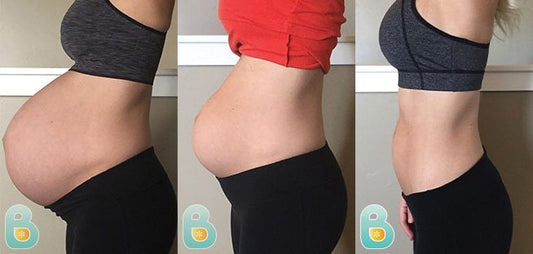 56-Erin-E-Bellefit-Results-Before-and-After-Bellefit-SLIDE