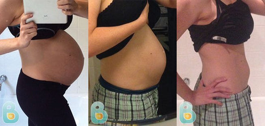 57-Esther-Y-Bellefit-Results-Before-and-After-Bellefit-SLIDE