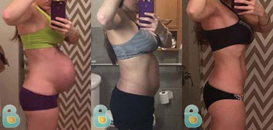 6-Amanda-K-Bellefit-Results-Before-and-After-Bellefit-SLIDE