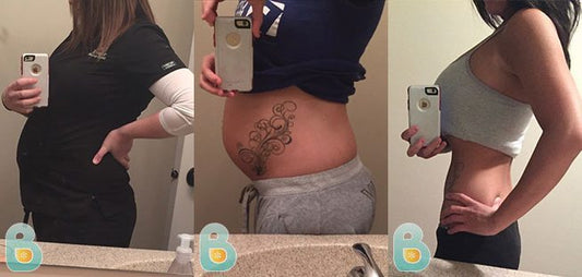 60-Haley-V-Bellefit-Results-Before-and-After-Bellefit-SLIDE