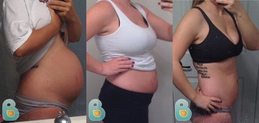 62-Heather-E-Bellefit-Results-Before-and-After-Bellefit-SLIDE