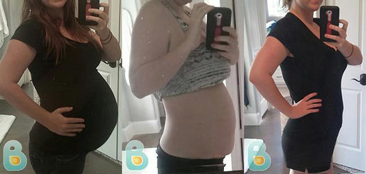 63-Heather-M-Bellefit-Results-Before-and-After-Bellefit-SLIDE