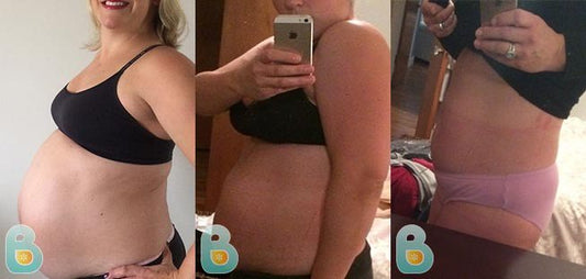 67-Jalie-L-Bellefit-Results-Before-and-After-Bellefit-SLIDE
