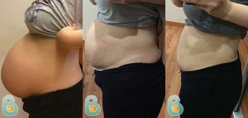 68-Jane-C-Bellefit-Results-Before-and-After-Bellefit-SLIDE