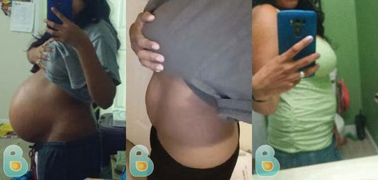 7-Amanda-R-Bellefit-Results-Before-and-After-Bellefit-SLIDE