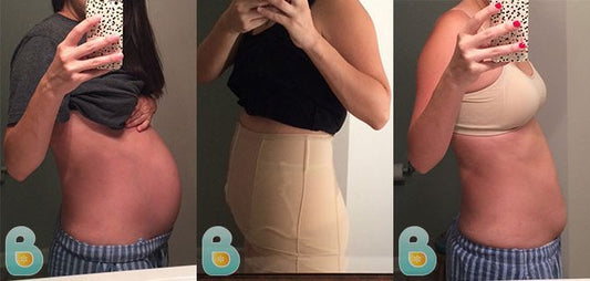 70-Jenna-R-Bellefit-Results-Before-and-After-Bellefit-SLIDE