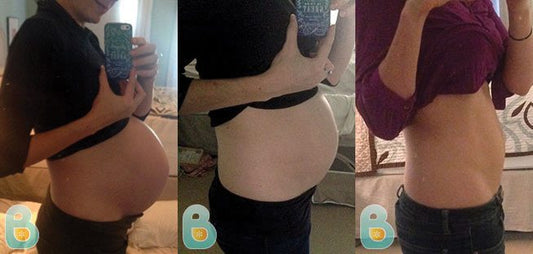 71-Jenni-G-Bellefit-Results-Before-and-After-Bellefit-SLIDE