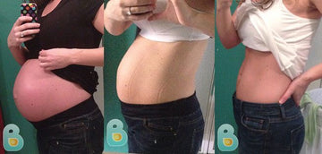 72-Jennifer-B-Bellefit-Results-Before-and-After-Bellefit-SLIDE