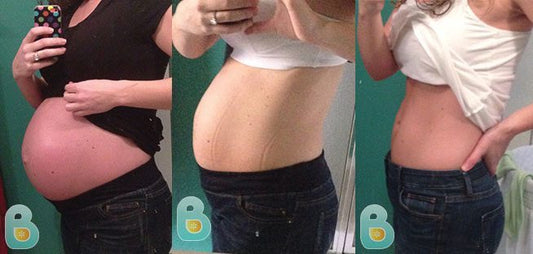 72-Jennifer-B-Bellefit-Results-Before-and-After-Bellefit-SLIDE