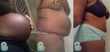 76-Juanita-T-Bellefit-Results-Before-and-After-Bellefit-SLIDE