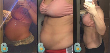 78-Kalen-C-Bellefit-Results-Before-and-After-Bellefit-SLIDE