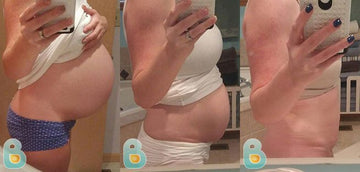 79-Kandis-H-Bellefit-Results-Before-and-After-Bellefit-SLIDE