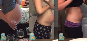 8-Amber-M-Bellefit-Results-Before-and-After-Bellefit-SLIDE