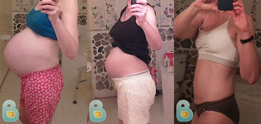 80-Karen-S-Bellefit-Results-Before-and-After-Bellefit-SLIDE