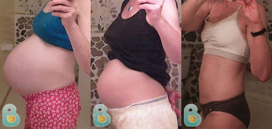 81-Karen-A-Bellefit-Results-Before-and-After-Bellefit-SLIDE