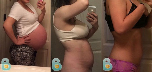 82-Karen-R-Bellefit-Results-Before-and-After-Bellefit-SLIDE
