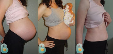 83-Karin-N-Bellefit-Results-Before-and-After-Bellefit-SLIDE