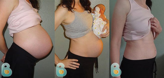 83-Karin-N-Bellefit-Results-Before-and-After-Bellefit-SLIDE