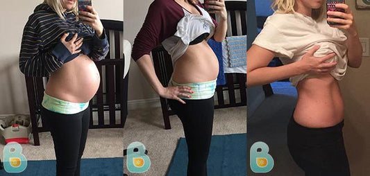 85-Kate-L-Bellefit-Results-Before-and-After-Bellefit-SLIDE