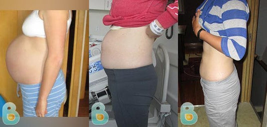 87-Katherine-E-Bellefit-Results-Before-and-After-Bellefit-SLIDE